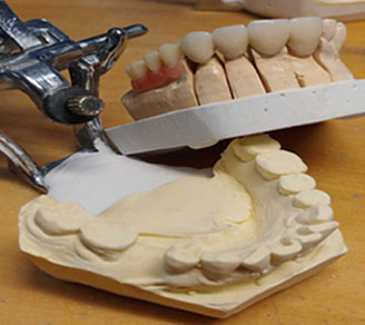 image merikis odontostixias